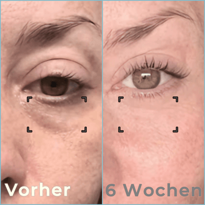 Bella Lift - Hautverjüngende Augenmaske