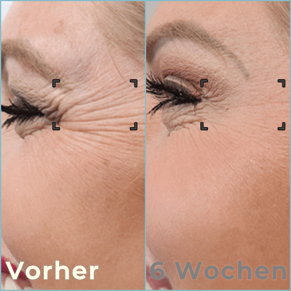 Bella Lift - Hautverjüngende Augenmaske