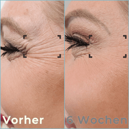 Bella Lift - Hautverjüngende Augenmaske