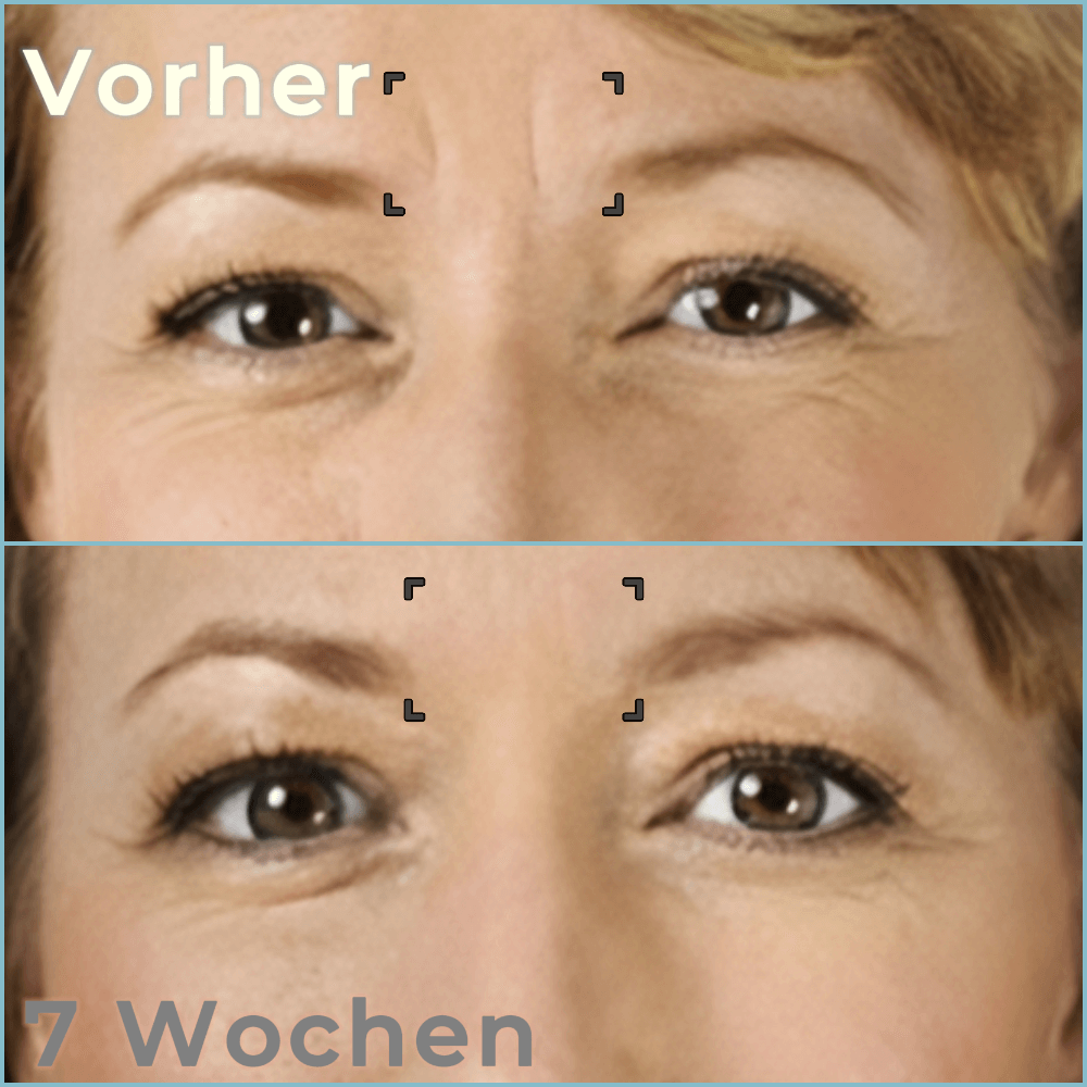 Bella Lift - Hautverjüngende Augenmaske