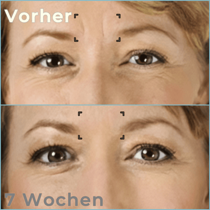 Bella Lift - Hautverjüngende Augenmaske