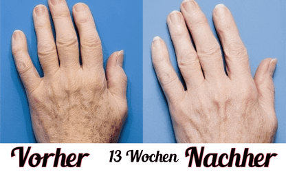 Lustra Hand Spa - Hautverjüngende Lichttherapie für Hände