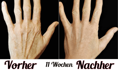 Lustra Hand Spa - Hautverjüngende Lichttherapie für Hände