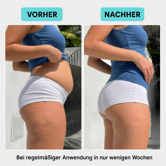 RondoPuls - Formungsroller gegen Cellulite und Umfang