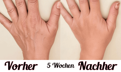 Lustra Band Go - Hautverjüngende Lichttherapie für Hände