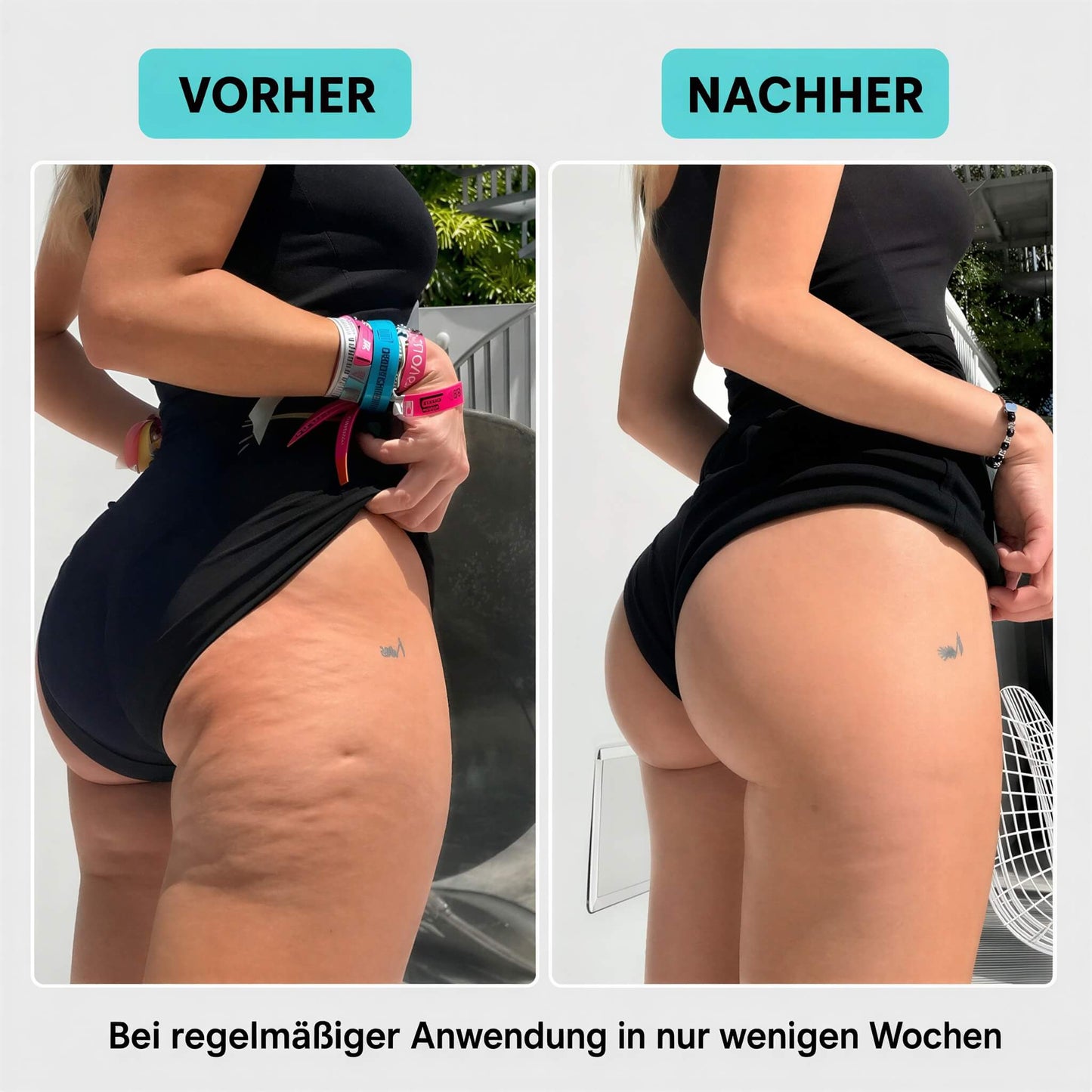 RondoPuls - Formungsroller gegen Cellulite und Umfang