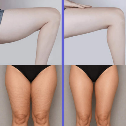 Zellavex Massagebogen