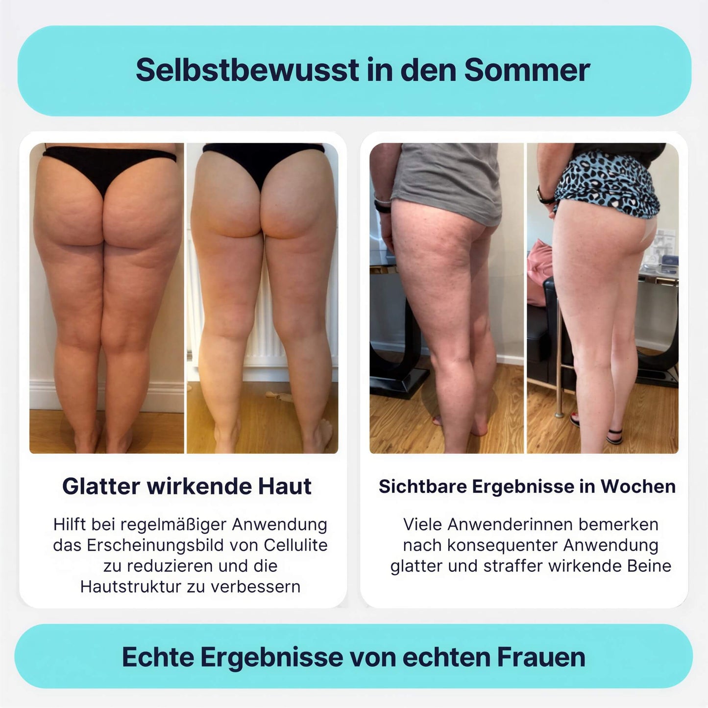 RondoPuls - Formungsroller gegen Cellulite und Umfang